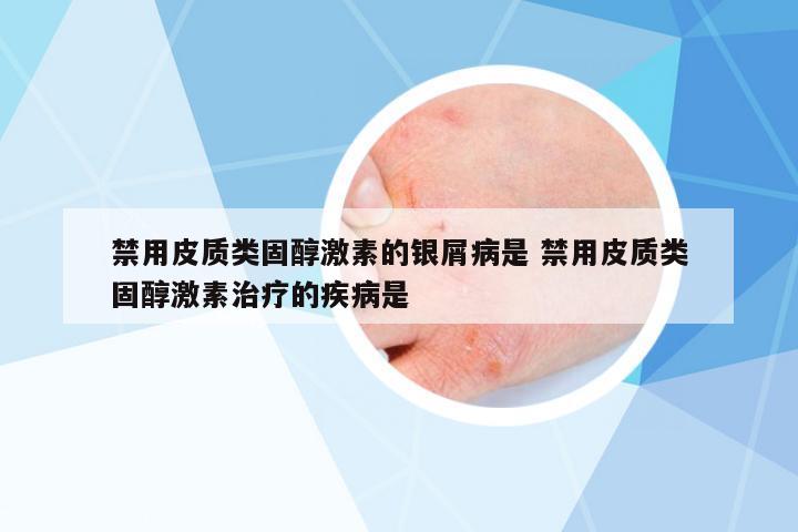 禁用皮質(zhì)類固醇激素的銀屑病是 禁用皮質(zhì)類固醇激素治療的疾病是