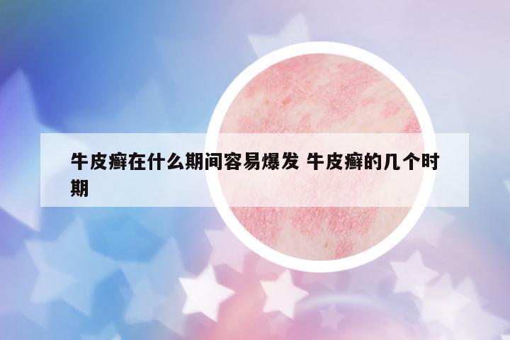 牛皮癬在什么期間容易爆發(fā) 牛皮癬的幾個時期