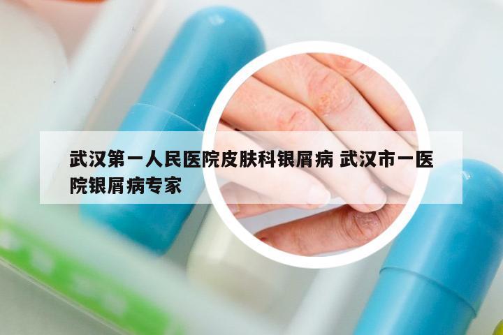 武漢第一人民醫(yī)院皮膚科銀屑病 武漢市一醫(yī)院銀屑病專家