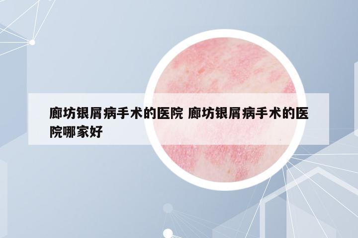 廊坊銀屑病手術(shù)的醫(yī)院 廊坊銀屑病手術(shù)的醫(yī)院哪家好
