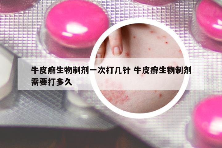 牛皮癬生物制劑一次打幾針 牛皮癬生物制劑需要打多久