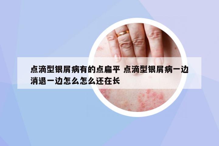 點滴型銀屑病有的點扁平 點滴型銀屑病一邊消退一邊怎么怎么還在長