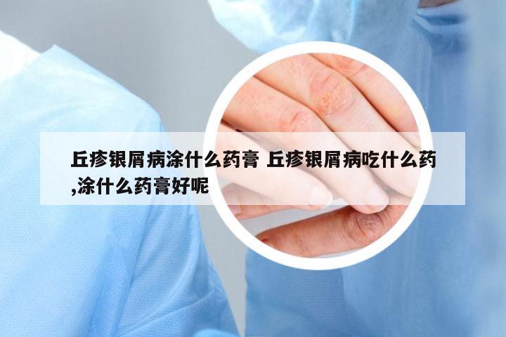 丘疹銀屑病涂什么藥膏 丘疹銀屑病吃什么藥,涂什么藥膏好呢