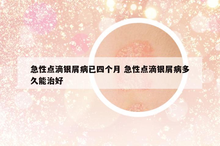 急性點滴銀屑病已四個月 急性點滴銀屑病多久能治好