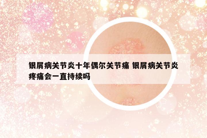 銀屑病關(guān)節(jié)炎十年偶爾關(guān)節(jié)痛 銀屑病關(guān)節(jié)炎疼痛會(huì)一直持續(xù)嗎