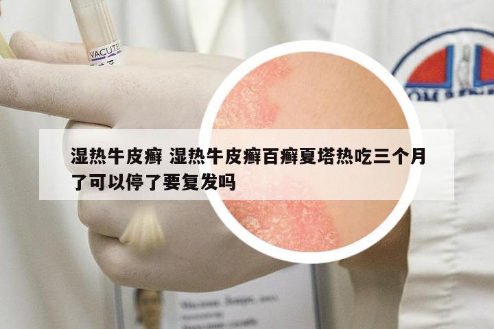 濕熱牛皮癬 濕熱牛皮癬百癬夏塔熱吃三個月了可以停了要復發(fā)嗎