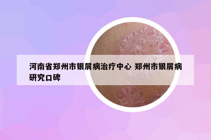 河南省鄭州市銀屑病治療中心 鄭州市銀屑病研究口碑