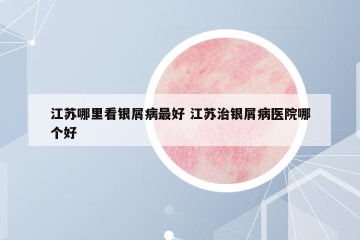 江蘇哪里看銀屑病最好 江蘇治銀屑病醫(yī)院哪個(gè)好
