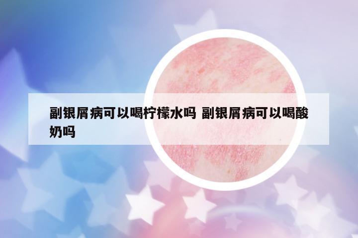 副銀屑病可以喝檸檬水嗎 副銀屑病可以喝酸奶嗎