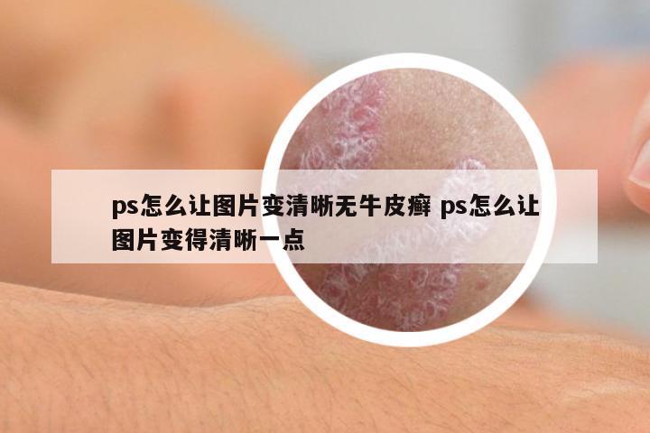 ps怎么讓圖片變清晰無(wú)牛皮癬 ps怎么讓圖片變得清晰一點(diǎn)