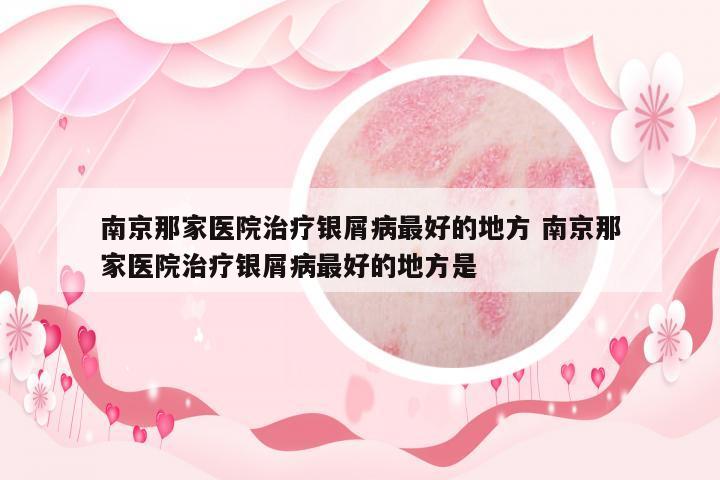 南京那家醫(yī)院治療銀屑病最好的地方 南京那家醫(yī)院治療銀屑病最好的地方是