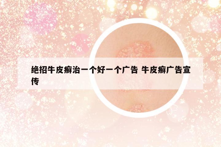 絕招牛皮癬治一個(gè)好一個(gè)廣告 牛皮癬廣告宣傳