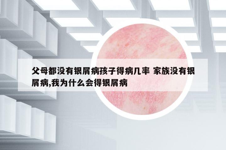 父母都沒(méi)有銀屑病孩子得病幾率 家族沒(méi)有銀屑病,我為什么會(huì)得銀屑病
