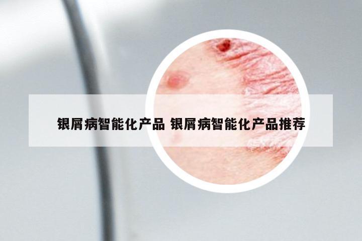 銀屑病智能化產(chǎn)品 銀屑病智能化產(chǎn)品推薦