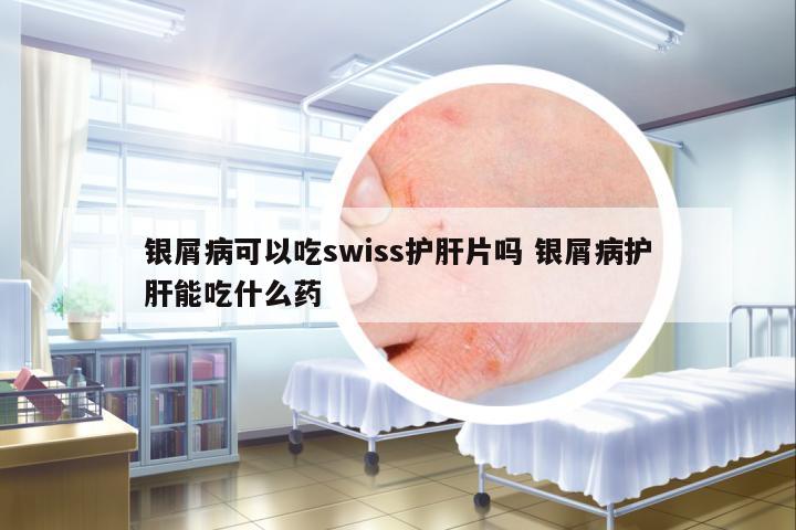 銀屑病可以吃swiss護肝片嗎 銀屑病護肝能吃什么藥