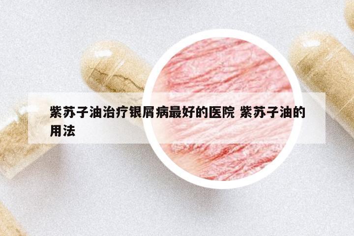 紫蘇子油治療銀屑病最好的醫(yī)院 紫蘇子油的用法