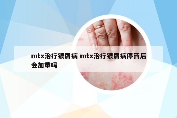 mtx治療銀屑病 mtx治療銀屑病停藥后會加重嗎