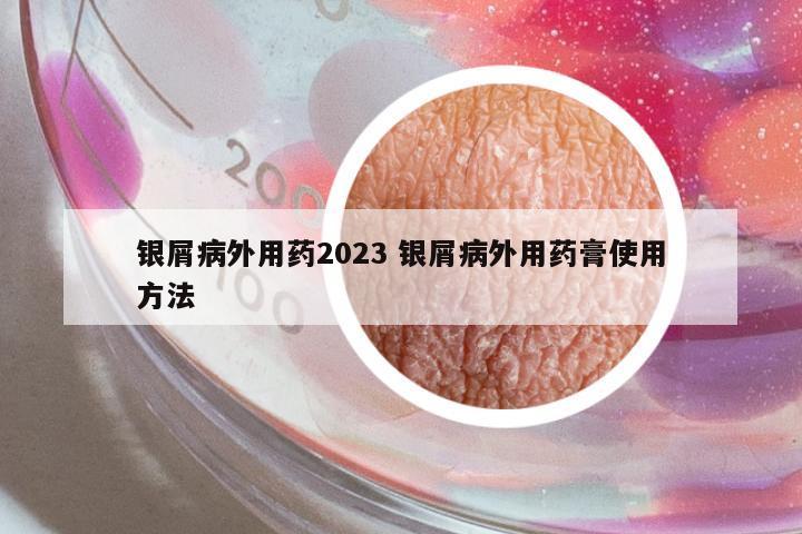 銀屑病外用藥2023 銀屑病外用藥膏使用方法