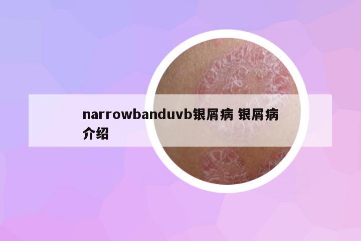 narrowbanduvb銀屑病 銀屑病介紹