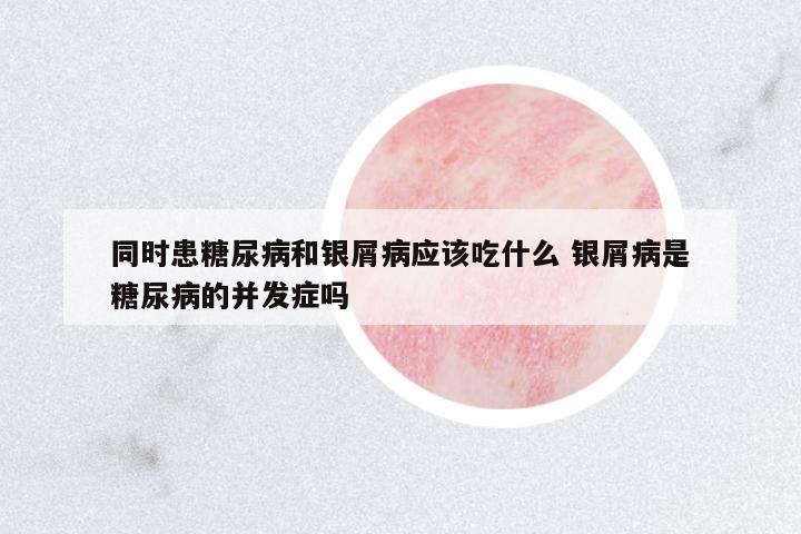 同時(shí)患糖尿病和銀屑病應(yīng)該吃什么 銀屑病是糖尿病的并發(fā)癥嗎