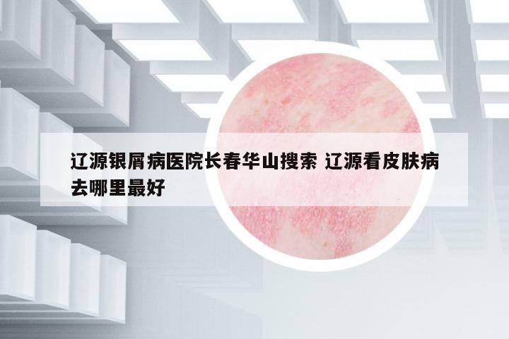 遼源銀屑病醫(yī)院長春華山搜索 遼源看皮膚病去哪里最好