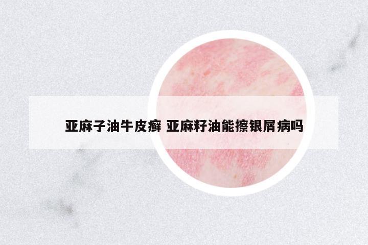 亞麻子油牛皮癬 亞麻籽油能擦銀屑病嗎