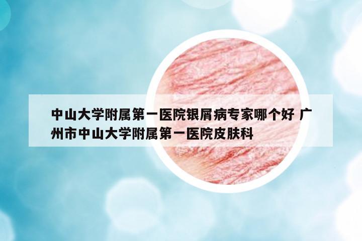 中山大學附屬第一醫(yī)院銀屑病專家哪個好 廣州市中山大學附屬第一醫(yī)院皮膚科