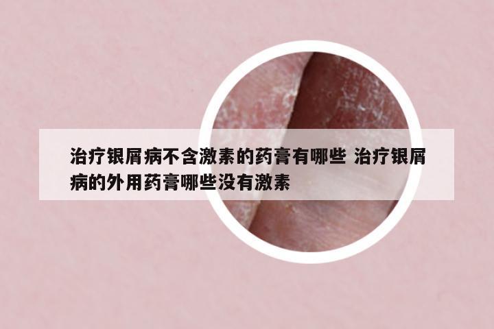 治療銀屑病不含激素的藥膏有哪些 治療銀屑病的外用藥膏哪些沒有激素