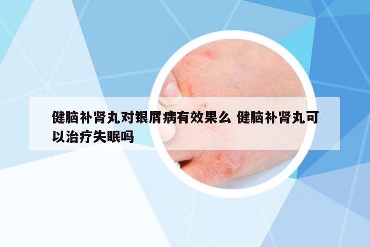 健腦補腎丸對銀屑病有效果么 健腦補腎丸可以治療失眠嗎