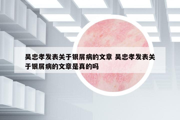 吳忠孝發(fā)表關(guān)于銀屑病的文章 吳忠孝發(fā)表關(guān)于銀屑病的文章是真的嗎