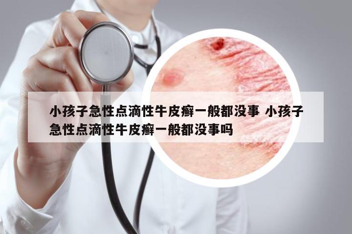 小孩子急性點(diǎn)滴性牛皮癬一般都沒事 小孩子急性點(diǎn)滴性牛皮癬一般都沒事嗎
