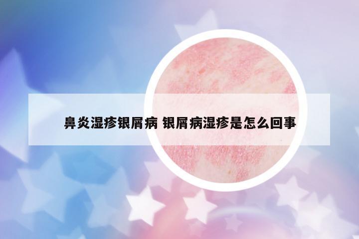 鼻炎濕疹銀屑病 銀屑病濕疹是怎么回事