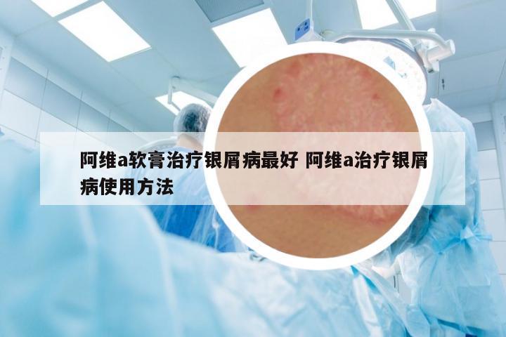 阿維a軟膏治療銀屑病最好 阿維a治療銀屑病使用方法
