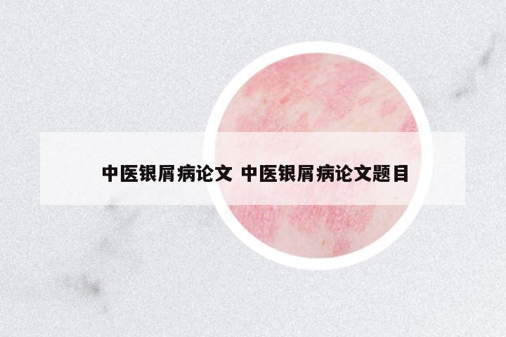 中醫(yī)銀屑病論文 中醫(yī)銀屑病論文題目